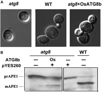 A Rice Autophagy Gene OsATG8b Is Involved in Nitrogen Remobilization and Control of Grain Quality